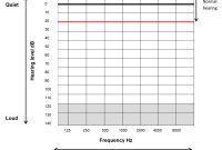 Blank Audiogram Chart – Trinity pertaining to Blank Audiogram Template Download