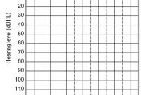 Blank Audiogram Chart – Trinity within Blank Audiogram Template Download