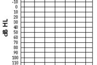 Blank Audiogram Chart – Trinity within Blank Audiogram Template Download