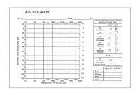 Blank Audiogram Template Download – Free Download for Blank Audiogram Template Download