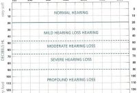 Pin On Blank Template inside Blank Audiogram Template Download
